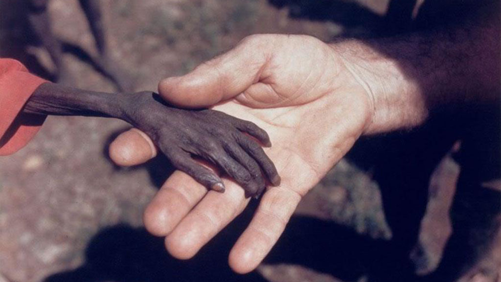 Child starving, Karamoja, Uganda, 1980